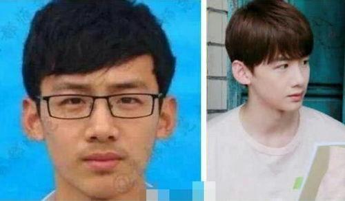 明星鼻子前后对比,揭秘鼻子前后对比的惊人变化