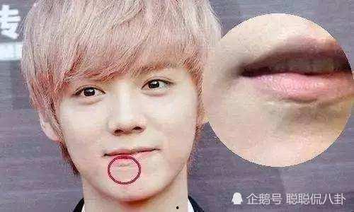 明星疤痕图片,揭秘明星疤痕背后的心酸历程