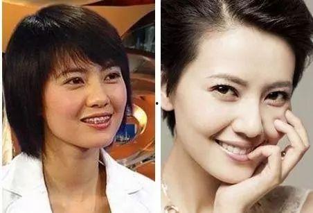 下颚骨突出明星图片,揭秘下颚骨突出明星的独特魅力